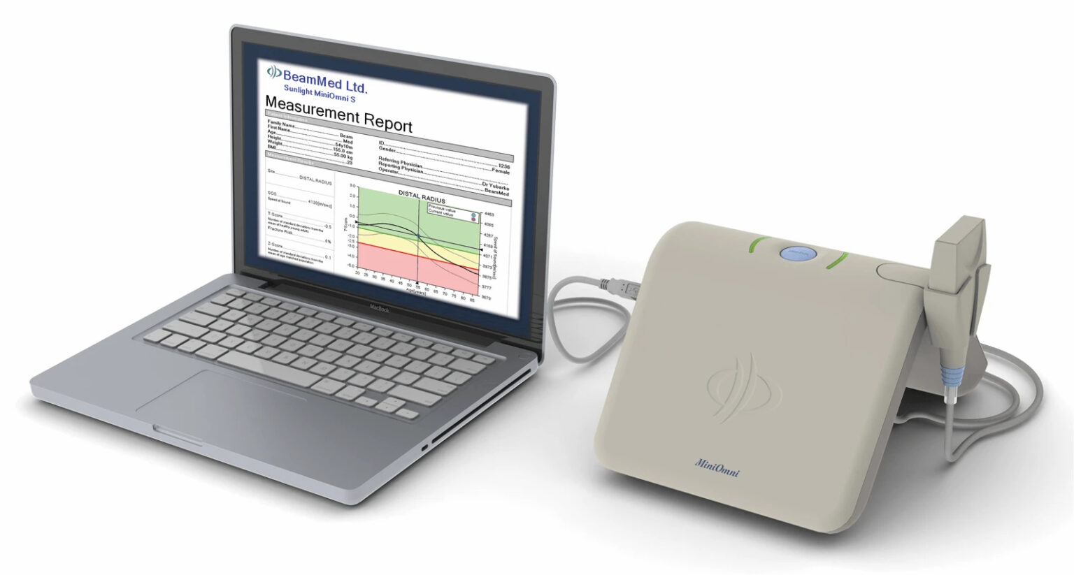 Beammed Miniomni Testing For Osteoporosis Biomedix