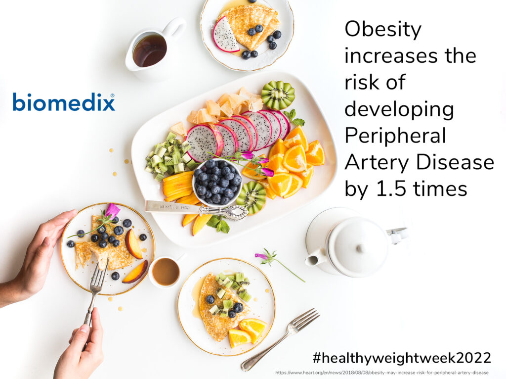 Obesity Increases The Risk Of Developing PAD by 1.5 Times