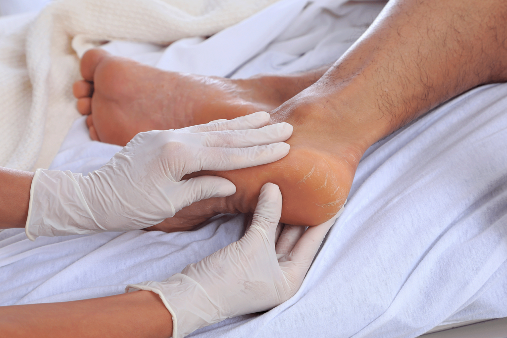 Diabetic foot examination